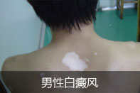 ԰综ô׼ȷ